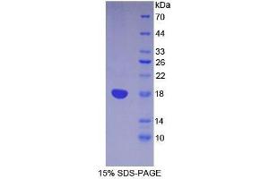 SDS-PAGE analysis of Mouse Lymphocyte Antigen 96 Protein. (LY96 Protéine)