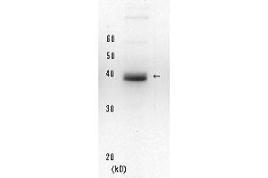 Western Blotting (WB) image for anti-Xeroderma Pigmentosum, Complementation Group A (XPA) (full length) antibody (ABIN3200998) (XPA anticorps  (full length))