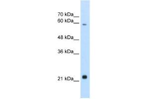 WB Suggested Anti-RBPJL Antibody Titration:  2. (RBPJL anticorps  (N-Term))