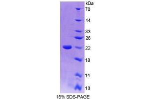 SDS-PAGE analysis of Mouse TRERF1 Protein. (TRERF1 Protéine)