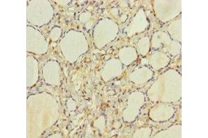 Immunohistochemistry of paraffin-embedded human thyroid tissue using ABIN7154959 at dilution of 1:100 (HEBP2 anticorps  (AA 2-205))