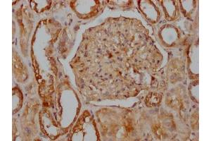 IHC image of ABIN7127577 diluted at 1:100 and staining in paraffin-embedded human kidney tissue performed on a Leica BondTM system. (Recombinant CD51 anticorps)