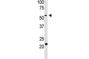 Western Blotting (WB) image for anti-beta-Site APP-Cleaving Enzyme 2 (BACE2) antibody (ABIN3002512) (BACE2 anticorps)