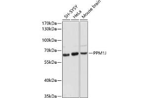 Western blot analysis of extracts of various cell lines, using PPM1J antibody (ABIN6132509, ABIN6146046, ABIN6146047 and ABIN6216619) at 1:3000 dilution. (PPM1J anticorps  (AA 130-260))