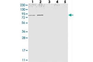 Western blot analysis of Lane 1: RT-4, Lane 2: U-251 MG, Lane 3: Human Plasma, Lane 4: Liver, Lane 5: Tonsil with NOL11 polyclonal antibody  at 1:250-1:500 dilution. (NOL11 anticorps)