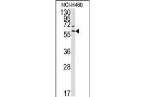 Western blot analysis of anti-MMP17 Antibody in NCI-H460 cell line lysates (35ug/lane). (MMP17 anticorps  (AA 391-420))