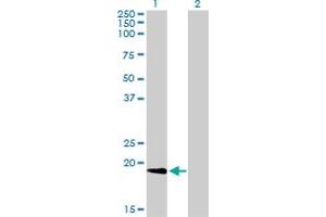 Western Blot analysis of NME1 expression in transfected 293T cell line by NME1 monoclonal antibody (M01), clone 2H1.
