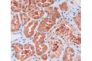 Used in DAB staining on fromalin fixed paraffin- embedded Kidney tissue