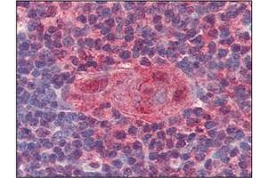 Immunohistochemistry (IHC) image for anti-Uracil-DNA Glycosylase (UNG) (AA 1-313), (N-Term) antibody (ABIN317576) (UNG anticorps  (N-Term))