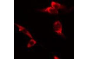 ABIN6275496 staining RAW264. (ARHGEF12 anticorps  (Internal Region))