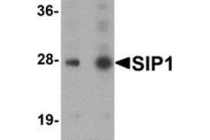 Western blot analysis of SIP1 in HeLa cell lysate with SIP1 antibody at (A) 0. (SIP1 anticorps  (C-Term))