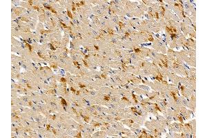 ABIN6259384 and ABIN6276149 at 1/100 staining rat heart tissue by IHC-P.