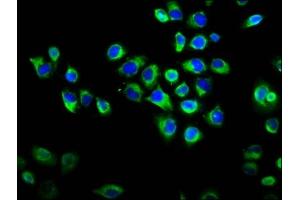 Immunofluorescence staining of Hela cells with ABIN7167104 at 1:133, counter-stained with DAPI. (RAPGEF2 anticorps  (AA 1393-1498))