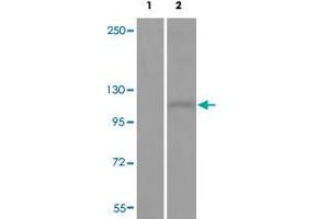 Western blot analysis of Lane 1: antigen-specific peptide treated JK cells, Lane 2: JK cells with DDR1 (phospho Y513) polyclonal antibody  at 1:500-1000 dilution. (DDR1 anticorps  (pTyr513))