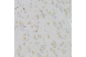 Immunohistochemistry of paraffin-embedded mouse brain using MAP2K5 Antibody (ABIN5974181) at dilution of 1/100 (40x lens). (MAP2K5 anticorps)