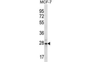 Western blot analysis of PSMB10 Antibody (C-term) in MCF-7 cell line lysates (35ug/lane). (PSMB10 anticorps  (C-Term))