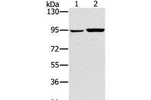 Western Blot analysis of 231 and PC3 cell using PYGL Polyclonal Antibody at dilution of 1:400 (PYGL anticorps)