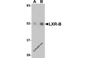 Western Blotting (WB) image for anti-Nuclear Receptor Subfamily 1, Group H, Member 2 (NR1H2) (N-Term) antibody (ABIN1031444) (NR1H2 anticorps  (N-Term))