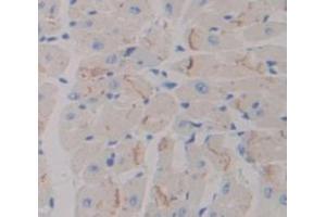 IHC-P analysis of Kidney tissue, with DAB staining. (ADCY7 anticorps  (AA 309-491))