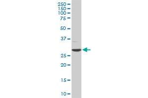 CDK4 monoclonal antibody (M05), clone 2A1. (CDK4 anticorps  (AA 211-303))
