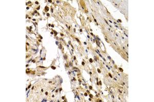 Immunohistochemistry of paraffin-embedded human colon injury using TFDP1 antibody. (DP1 anticorps)