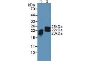 Western blot analysis of (1) Human SW480 Cells and (2) Human Urine. (Lipocalin 2 anticorps  (AA 21-198))