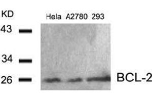 Image no. 3 for anti-B-Cell CLL/lymphoma 2 (BCL2) (AA 54-58) antibody (ABIN197202) (Bcl-2 anticorps  (AA 54-58))