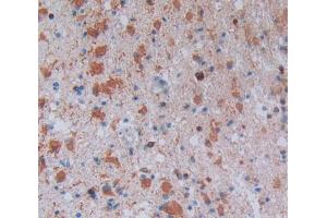 Used in DAB staining on fromalin fixed paraffin- embedded glioma tissue (CD1e anticorps  (AA 39-276))