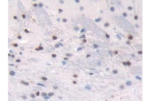 Detection of TALDO1 in Mouse Cerebrum Tissue using Polyclonal Antibody to Transaldolase (TALDO1) (TALDO1 anticorps  (AA 35-285))