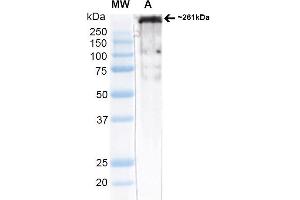 Western Blot analysis of Rat brain membrane lysate (native) showing detection of ~261 kDa Cav3. (CACNA1H anticorps  (AA 1019-1293))