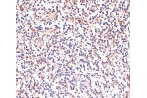 Immunohistochemistry of paraffin-embedded Human tonsil using Phospho-PEA15(S104) Polyclonal Antibody at dilution of 1:100 (40x lens).