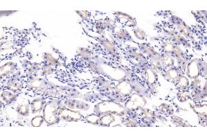 Detection of HDAC6 in Mouse Kidney Tissue using Polyclonal Antibody to Histone Deacetylase 6 (HDAC6)