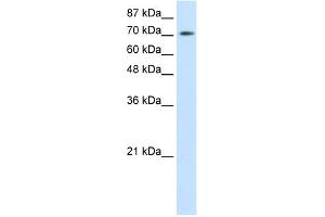 WB Suggested Anti-ZBTB48 Antibody Titration:  0. (ZBTB48 anticorps  (N-Term))