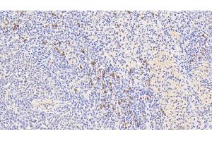 Detection of S100A9 in Human Spleen Tissue using Polyclonal Antibody to S100 Calcium Binding Protein A9 (S100A9) (S100A9 anticorps  (AA 1-114))