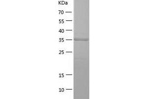 Western Blotting (WB) image for phosphoserine Aminotransferase 1 (PSAT1) (AA 1-370) protein (His-IF2DI Tag) (ABIN7124449)