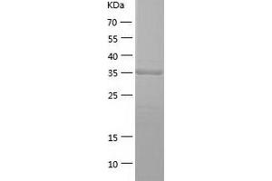 Western Blotting (WB) image for phosphoserine Aminotransferase 1 (PSAT1) (AA 1-370) protein (His tag) (ABIN7124449) (PSAT1 Protein (AA 1-370) (His tag))