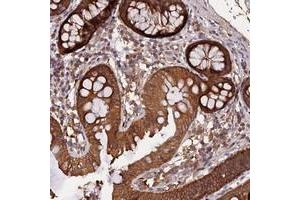 Immunohistochemical staining of human colon with MARK4 polyclonal antibody  shows moderate cytoplasmic positivity in glandular cells. (MARK4 anticorps)