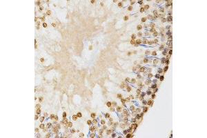 Immunohistochemistry of paraffin-embedded rat testis using DiMethyl-Histone H3-K9 antibody.