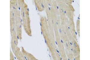 Immunohistochemistry of paraffin-embedded Mouse heart using PRPH Polyclonal Antibody at dilution of 1:100 (40x lens). (Peripherin anticorps)