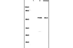 L1 human colon carcinoma lysates L2 rat brain lysates probed with Anti- WT-1/Wilms Tumor Protein Polyclonal Antibody, Unconjugated (ABIN1386293) at 1:200 in 4 °C.