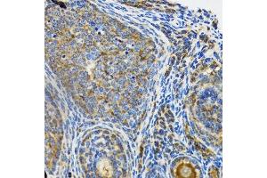 Immunohistochemistry of paraffin-embedded rat ovary using IRAK4 antibody.