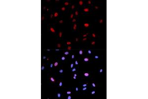Immunofluorescence analysis of U2OS cells using Phospho-MAP2K6-S207/MAP2K3-S189 antibody (ABIN5969926). (MAP2K6 anticorps  (pSer207))