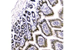 IHC analysis of Cbx8 using anti-Cbx8 antibody (ABIN7599341).