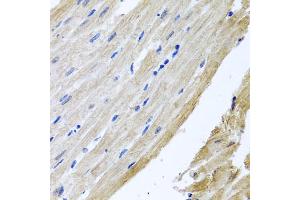 Immunohistochemistry of paraffin-embedded rat heart using PRPH antibody (ABIN5972212) at dilution of 1/100 (40x lens). (Peripherin anticorps)