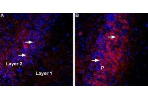 Expression of VGLUT3 in rat and mouse brain - Immunohistochemical staining of perfusion-fixed frozen rat and mouse brain sections using Anti-VGLUT3 Antibody (ABIN7043680, ABIN7044372 and ABIN7044373), (1:400), followed by anti-rabbit-Cy3 antibody (red).