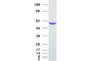 Validation with Western Blot