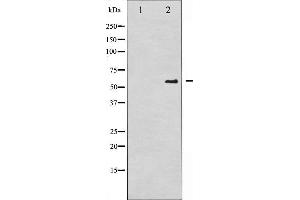 Western blot analysis of CDC25A phosphorylation expression in UV treated A2780 whole cell lysates,The lane on the left is treated with the antigen-specific peptide. (CDC25A anticorps  (pSer75))