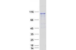 Validation with Western Blot