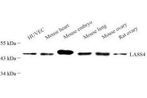 Western blot analysis of LASS4 (ABIN7073433) at dilution of 1: 1000 (LASS4 anticorps)