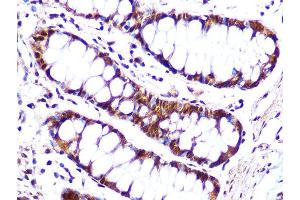 Immunohistochemistry of paraffin-embedded human colon using Cullin 4A Rabbit mAb (ABIN7266545) at dilution of 1:100 (40x lens). (Cullin 4A anticorps)